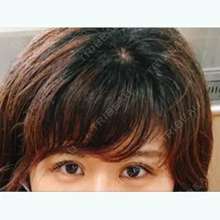 218日目の経過画像（2枚目）