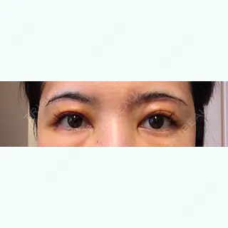 3日目の経過画像（1枚目）