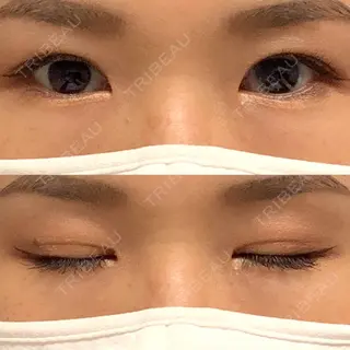 199日目の経過画像（2枚目）
