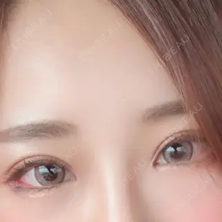 27日目の経過画像（1枚目）