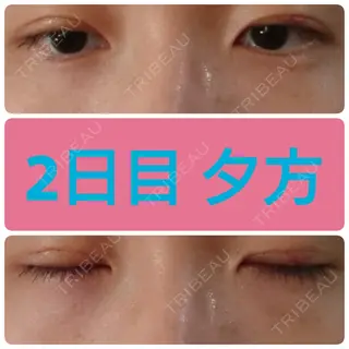 2日目の経過画像（1枚目）