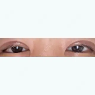 15日目の経過画像（1枚目）