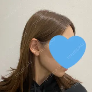 254日目の経過画像（2枚目）
