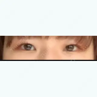 597日目の経過画像（3枚目）