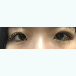 287日目の経過画像（3枚目）