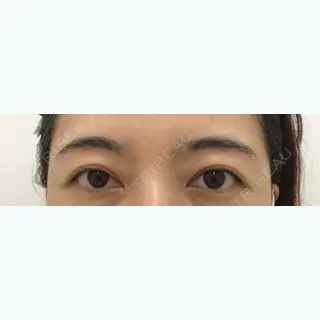 109日目の経過画像（1枚目）