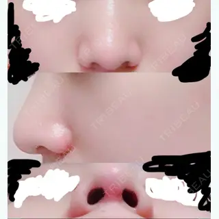 59日目の経過画像（1枚目）