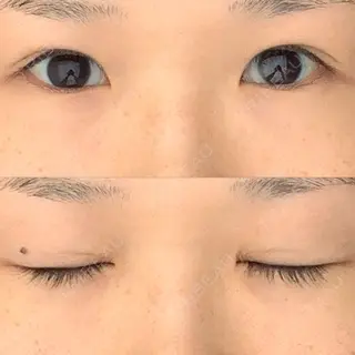 210日目の経過画像（1枚目）