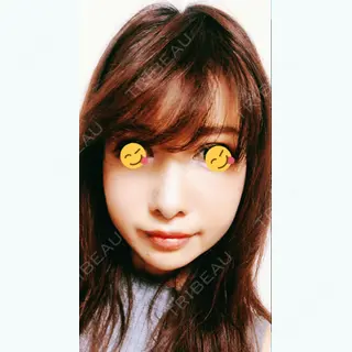 52日目の経過画像（1枚目）