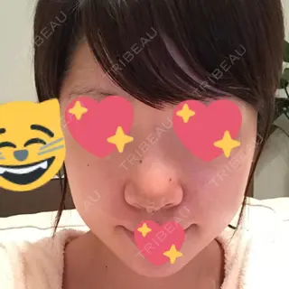 2日目の経過画像（1枚目）