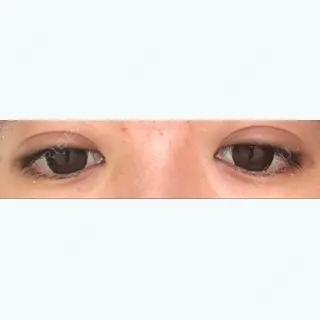 9日目の経過画像（2枚目）