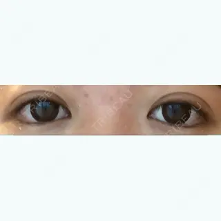 10日目の経過画像（1枚目）