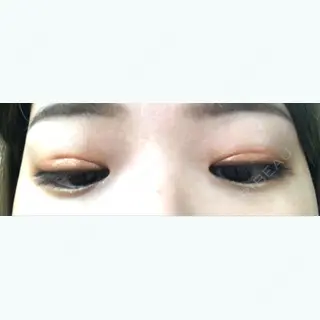 7日目の経過画像（2枚目）