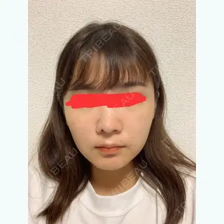 198日目の経過画像（1枚目）