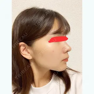 198日目の経過画像（2枚目）