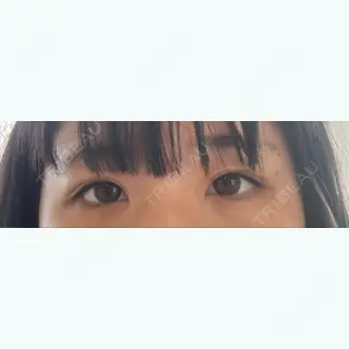 144日目の経過画像（3枚目）