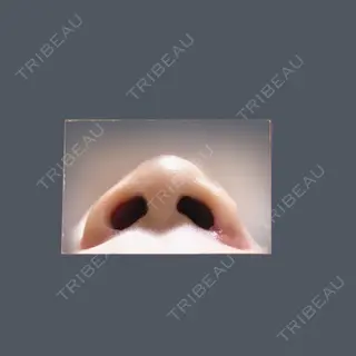 31日目の経過画像（2枚目）