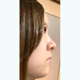 268日目の経過画像（2枚目）