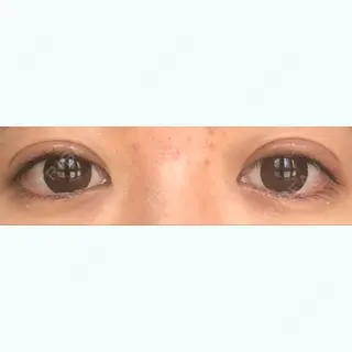 12日目の経過画像（1枚目）