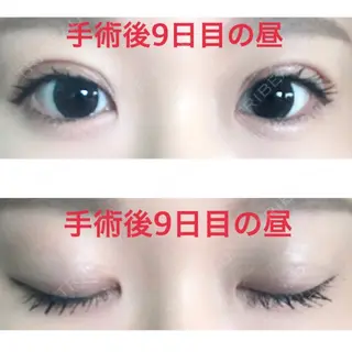 9日目の経過画像（1枚目）