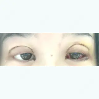 4日目の経過画像（1枚目）