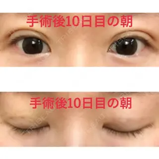 10日目の経過画像（1枚目）