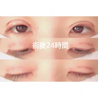 1日目の経過画像（2枚目）