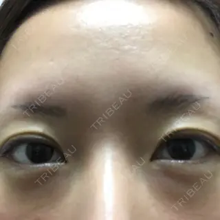 7日目の経過画像（1枚目）