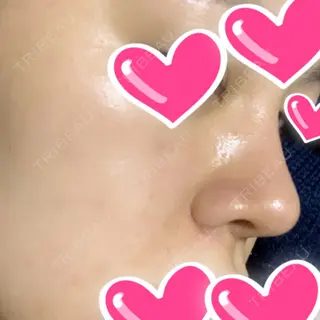 381日目の経過画像（2枚目）