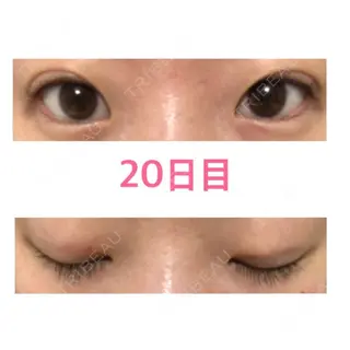 20日目の経過画像（1枚目）