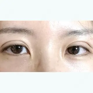 2日目の経過画像（1枚目）