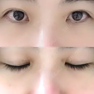 297日目の経過画像（1枚目）
