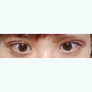 10日目の経過画像（1枚目）