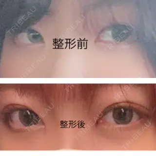 14日目の経過画像（2枚目）