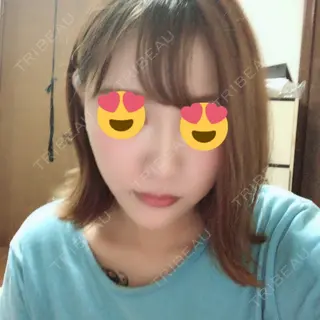 349日目の経過画像（2枚目）