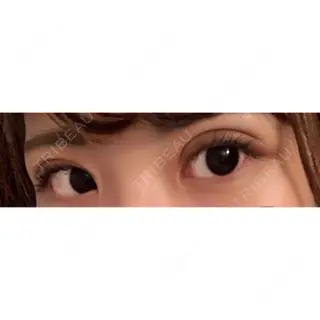 11日目の経過画像（2枚目）