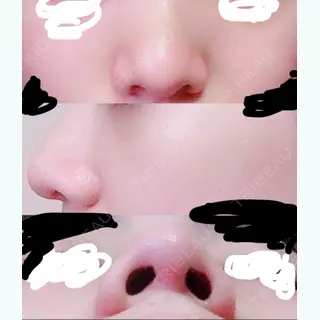 71日目の経過画像（1枚目）