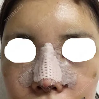 2日目の経過画像（1枚目）