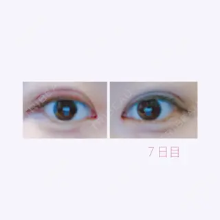 84日目の経過画像（1枚目）
