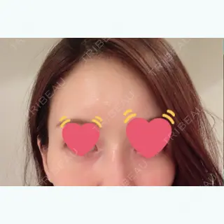 73日目の経過画像（1枚目）