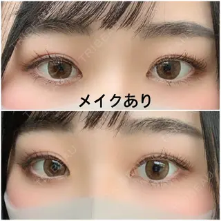240日目の経過画像（1枚目）