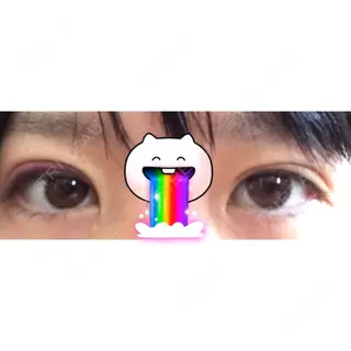 2日目の経過画像（1枚目）