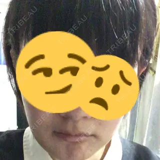 24日目の経過画像（1枚目）