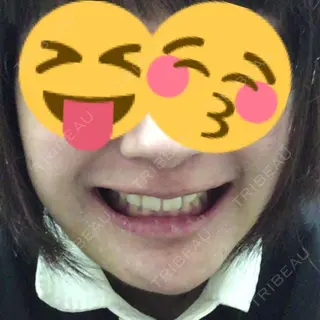 24日目の経過画像（2枚目）
