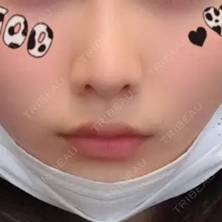621日目の経過画像（1枚目）