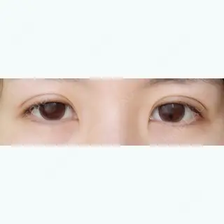 12日目の経過画像（1枚目）