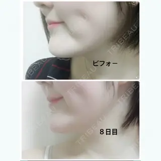 9日目の経過画像（2枚目）