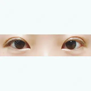57日目の経過画像（1枚目）