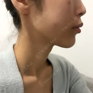 2日目の経過画像（2枚目）