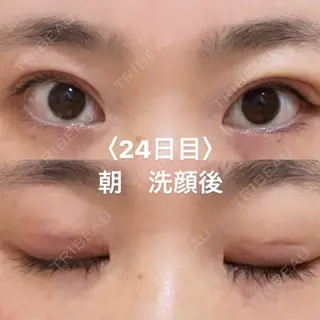 24日目の経過画像（1枚目）